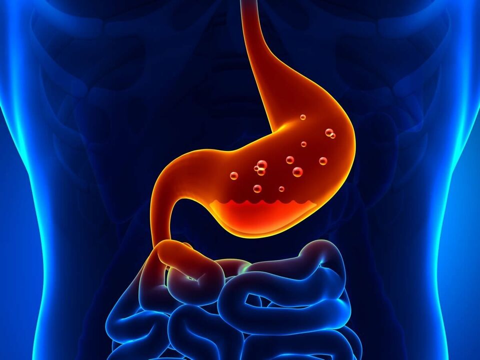 Gastritis is an inflammatory disease of the stomach that requires diet